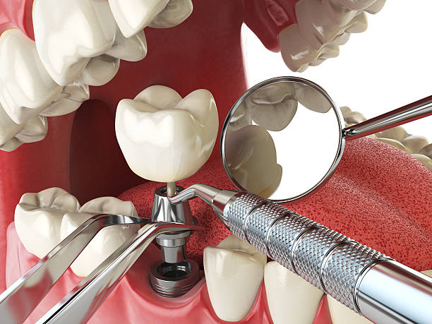 Best Emergency Tooth Extraction in Woodsi East, DE